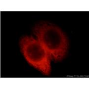 EML1 Rabbit Polyclonal Antibody (12765-1-AP)