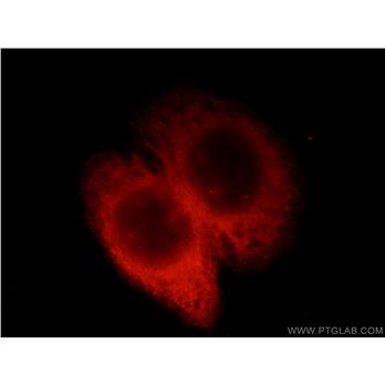 EML1 Rabbit Polyclonal Antibody (12765-1-AP)