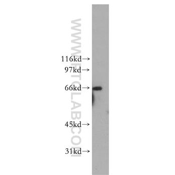 RPN1 Rabbit Polyclonal Antibody (12894-1-AP)