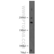 FANCM Rabbit Polyclonal Antibody (12954-1-AP)