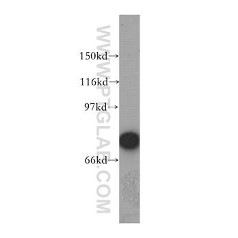 PPEF1 Rabbit Polyclonal Antibody (12875-1-AP)