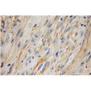 HAAO Rabbit Polyclonal Antibody (12791-1-AP)
