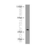 PAICS Rabbit Polyclonal Antibody (12967-1-AP)