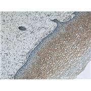 TGM1 Rabbit Polyclonal Antibody (12912-3-AP)