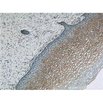 TGM1 Rabbit Polyclonal Antibody (12912-3-AP)