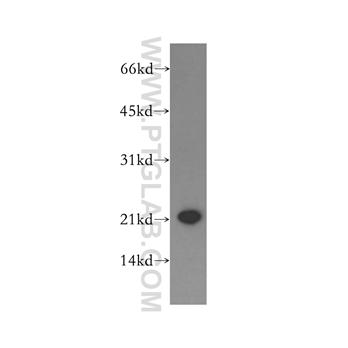 PGRMC1 Rabbit Polyclonal Antibody (12990-1-AP)