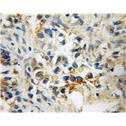 STOML1 Rabbit Polyclonal Antibody (12862-1-AP)