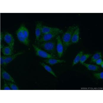 CLASP2 Rabbit Polyclonal Antibody (12942-1-AP)