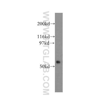 FBXO15 Rabbit Polyclonal Antibody (13024-1-AP)