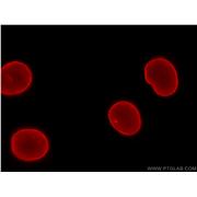 LMNB1 Rabbit Polyclonal Antibody (12987-1-AP)