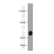 GATM Rabbit Polyclonal Antibody (12801-1-AP)