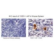 RAB37 Rabbit Polyclonal Antibody (13051-1-AP)