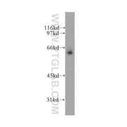 MSL3 Rabbit Polyclonal Antibody (12977-1-AP)
