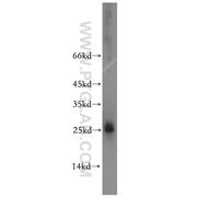 HMGB4 Rabbit Polyclonal Antibody (12787-1-AP)