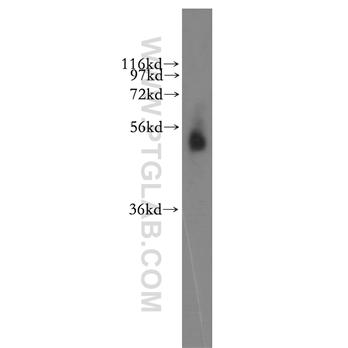 RASSF9 Rabbit Polyclonal Antibody (12861-1-AP)