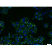FGFR2 Rabbit Polyclonal Antibody (13042-1-AP)