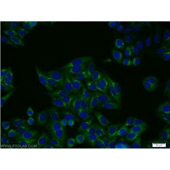 FGFR2 Rabbit Polyclonal Antibody (13042-1-AP)