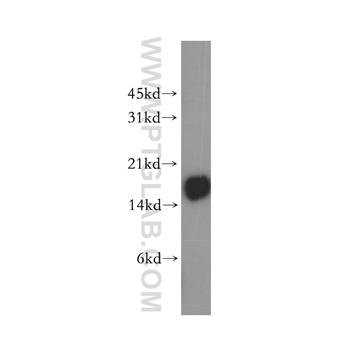 CD247 Rabbit Polyclonal Antibody (12837-2-AP)