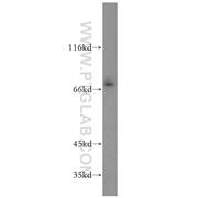 SLC1A6 Rabbit Polyclonal Antibody (12876-1-AP)