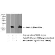 SNX22 Rabbit Polyclonal Antibody (13062-1-AP)