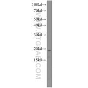 PFDN2 Rabbit Polyclonal Antibody (13053-1-AP)