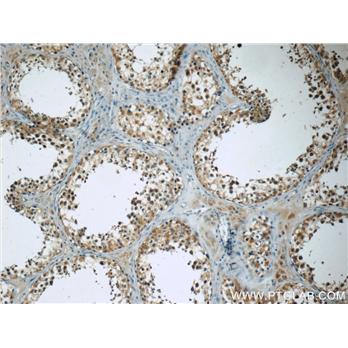 TEKT3 Rabbit Polyclonal Antibody (12959-1-AP)