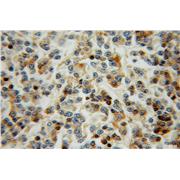 LCP1 Rabbit Polyclonal Antibody (13025-1-AP)