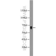AOAH Rabbit Polyclonal Antibody (12911-1-AP)