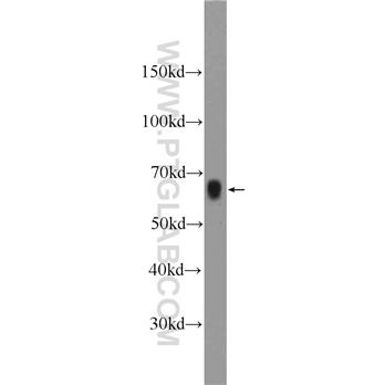 AOAH Rabbit Polyclonal Antibody (12911-1-AP)