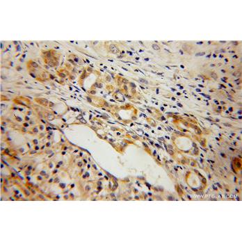 ELMOD2 Rabbit Polyclonal Antibody (13027-1-AP)