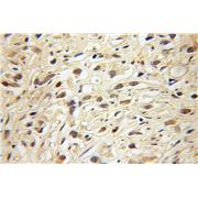 ARNT2 Rabbit Polyclonal Antibody (12810-1-AP)