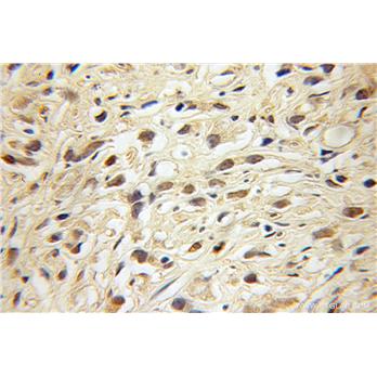 ARNT2 Rabbit Polyclonal Antibody (12810-1-AP)