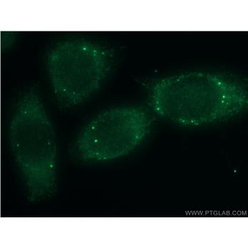 THRSP Rabbit Polyclonal Antibody (13054-1-AP)