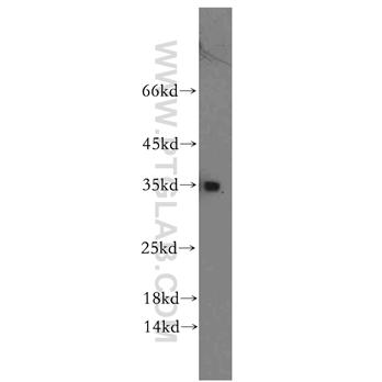 RCAN2 Rabbit Polyclonal Antibody (12900-1-AP)