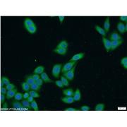 SECISBP2 Rabbit Polyclonal Antibody (12798-1-AP)