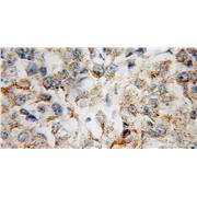 CBLB Rabbit Polyclonal Antibody (12781-1-AP)