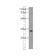 CHAD Rabbit Polyclonal Antibody (12963-1-AP)