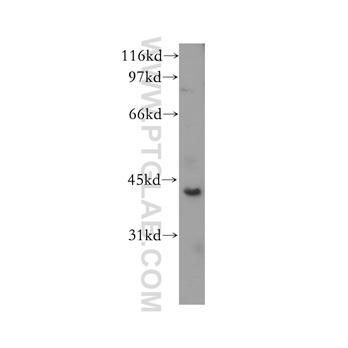 CHAD Rabbit Polyclonal Antibody (12963-1-AP)