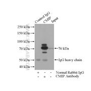 CMIP Rabbit Polyclonal Antibody (12851-1-AP)
