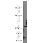 CNTN4 Rabbit Polyclonal Antibody (12777-1-AP)