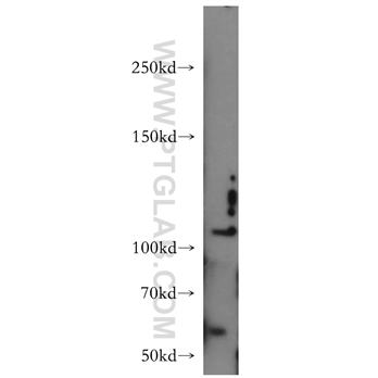 CNTN4 Rabbit Polyclonal Antibody (12777-1-AP)