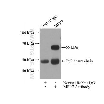 MPP7 Rabbit Polyclonal Antibody (12983-1-AP)