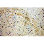 AADAT Rabbit Polyclonal Antibody (13031-1-AP)