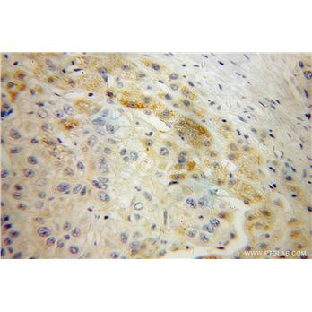 AADAT Rabbit Polyclonal Antibody (13031-1-AP)