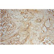 NME5 Rabbit Polyclonal Antibody (12923-1-AP)