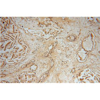 NME5 Rabbit Polyclonal Antibody (12923-1-AP)