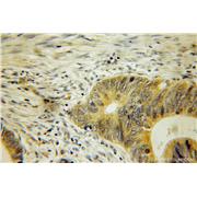 COASY Rabbit Polyclonal Antibody (12991-1-AP)