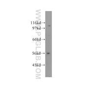 CUGBP2 Rabbit Polyclonal Antibody (12921-1-AP)