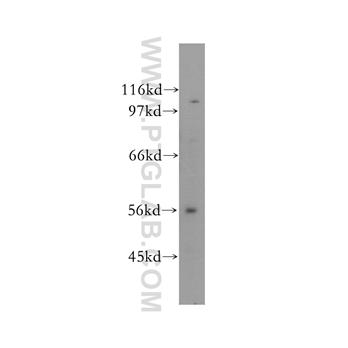 CUGBP2 Rabbit Polyclonal Antibody (12921-1-AP)