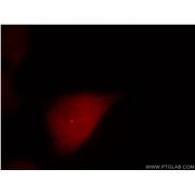 CETN1 Rabbit Polyclonal Antibody (12794-1-AP)